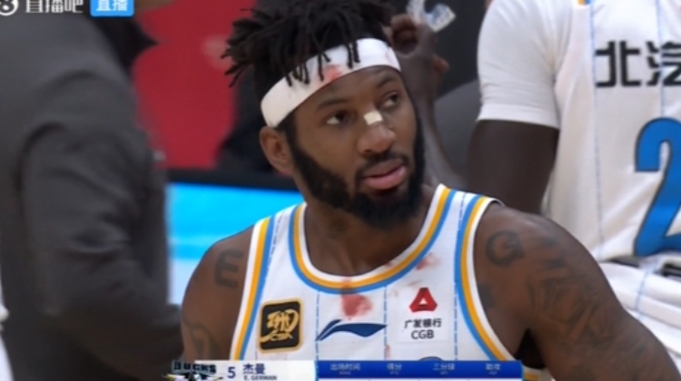 血迹斑斑🩸杰曼受伤的鼻梁仅贴一个创可贴 头带和衣服上全是血